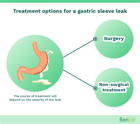 signs of gastric sleeve leak|Gastric Sleeve Leak: Signs & Symptoms of Staple Line Leak